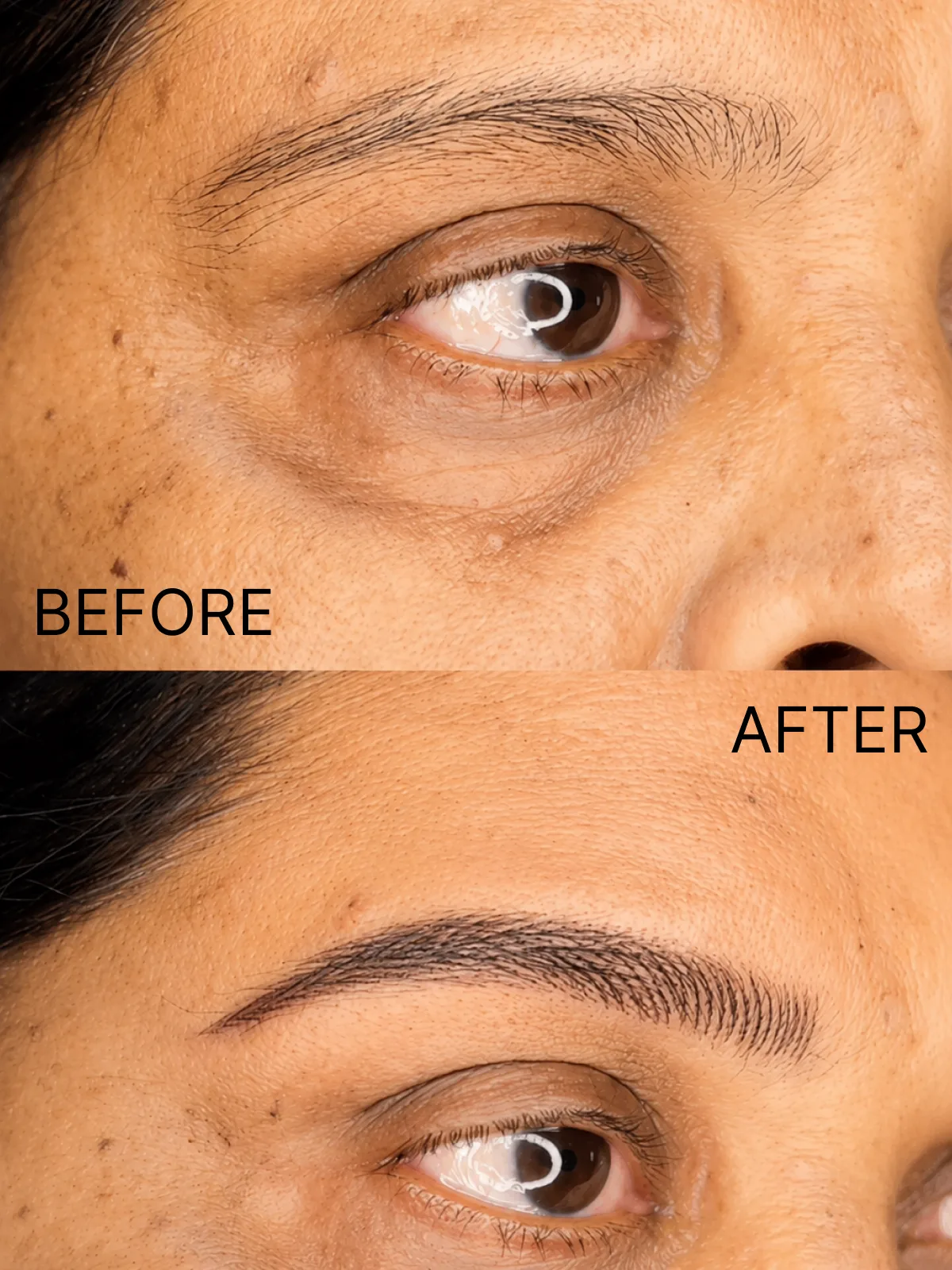 Permanent Eyebrows